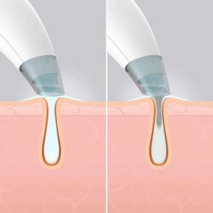 Homedics FAC-HY100 Refresh Hydra Facial